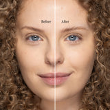 Billion Dollar Brow Lift