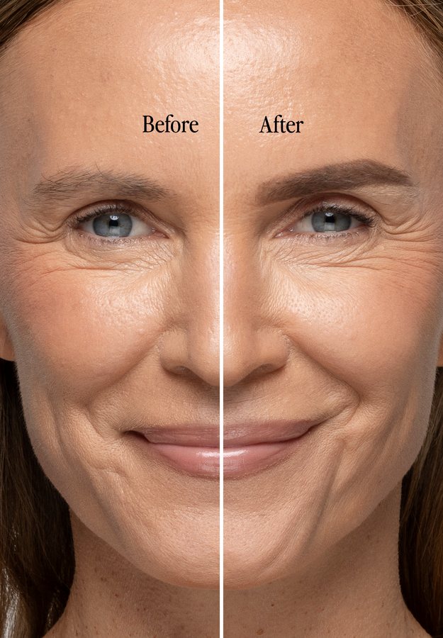 Real Brows With Billion Dollar Results