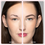 Brow Buddy® Kit