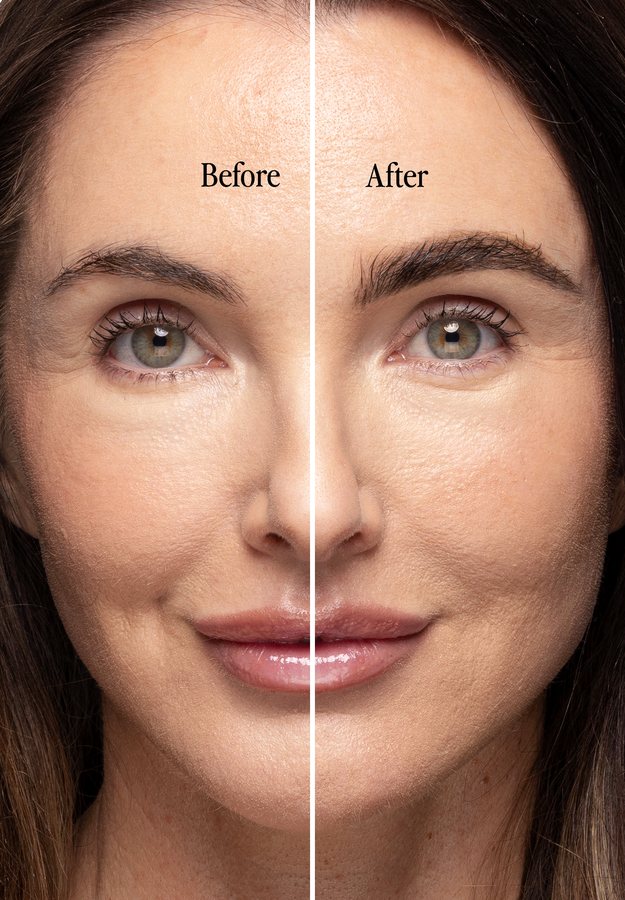 Real Brows With Billion Dollar Results